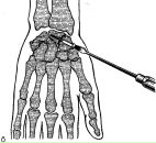 Фотография Буртнек Елена